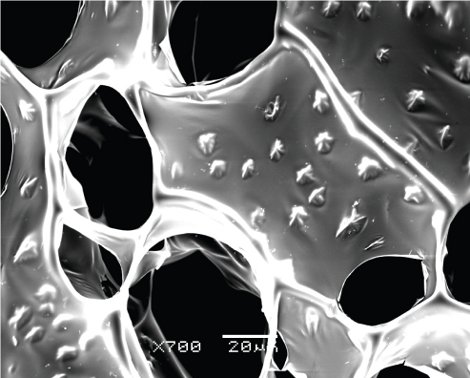 Nanofilamenti oro cuore infarto MIT