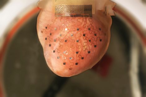 Heart device