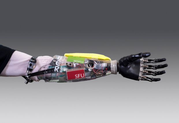 SFU bionic hand