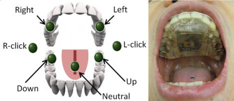 Tongue Drive System