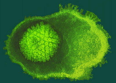 Varicella zoster virus sole