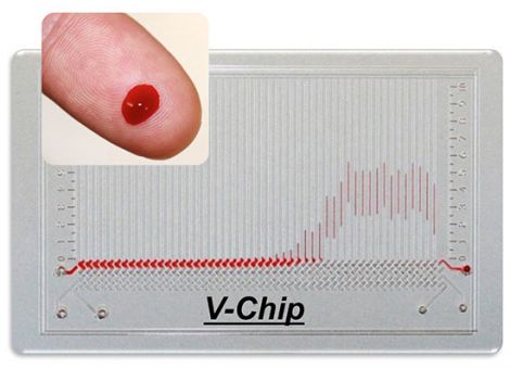 VCHIP