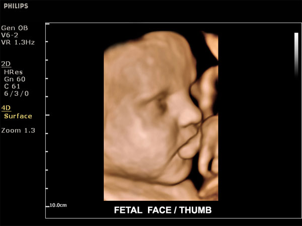 fetal face ultrasound