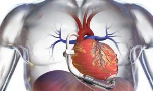 humanitas cuore artificiale internet