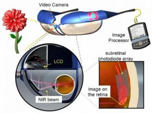 retina fotovoltaica occhio bionico